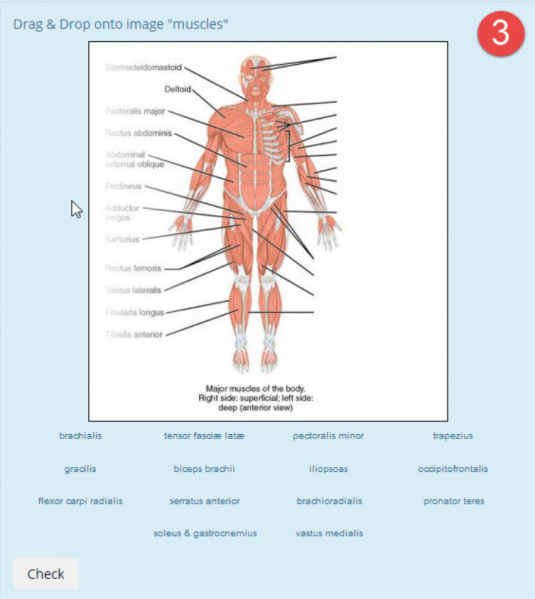 Archivo:DDinto image anatomy muscles example3.png