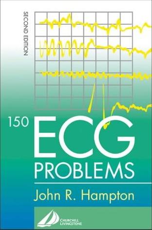Archivo:ECG Problems (150).jpg